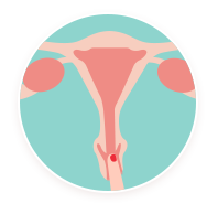 Col De L Uterus En Quoi Il Peut Indiquer Une Ovulation Ou Une Grossesse