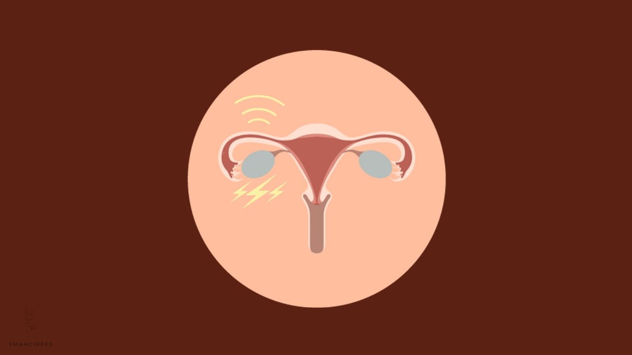 ovulation douloureuse